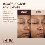 Ambi Even & Clear Advanced Fade Cream, Hydroquinone-free, Hyperpigmentation Treatment, Stubborn Dark Spot Corrector, Results In As Little 2-3 Weeks, Niacinamide, Licorice Root Extract, PHA, 1 Fl Oz - Image 7